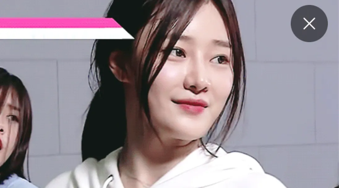 눈 트임했는데 깊이감이 없어질수도 있나요2