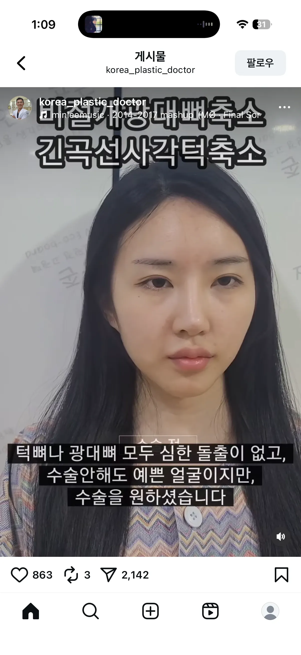 이정도면 효과좋은건가요..?