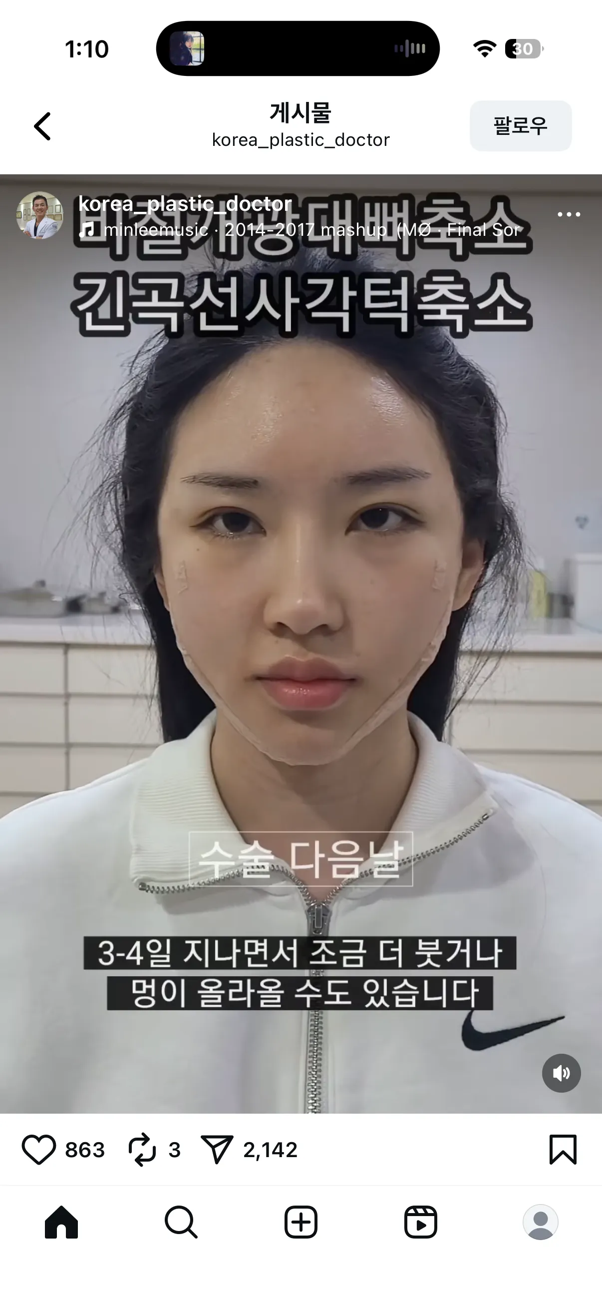 이정도면 효과좋은건가요..?2