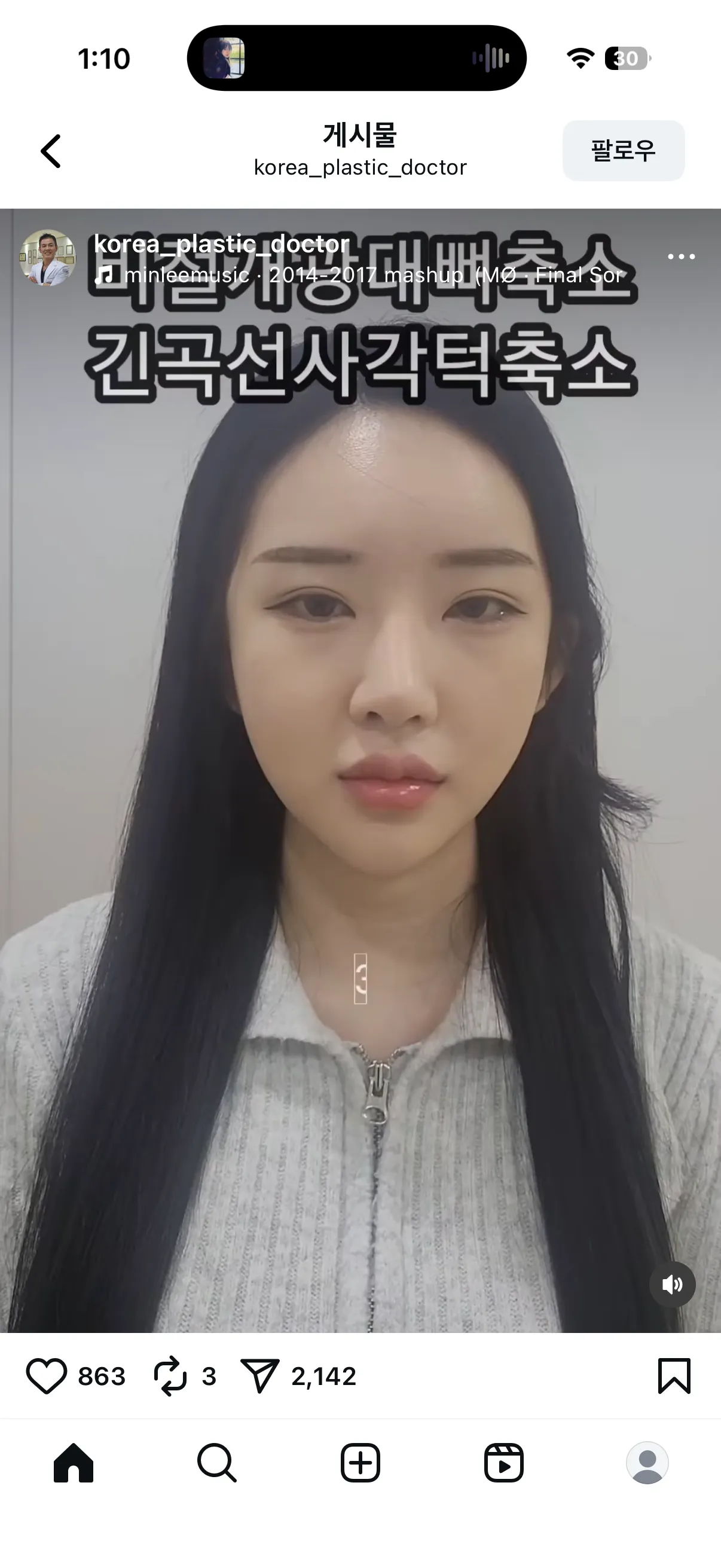 이정도면 효과좋은건가요..?3