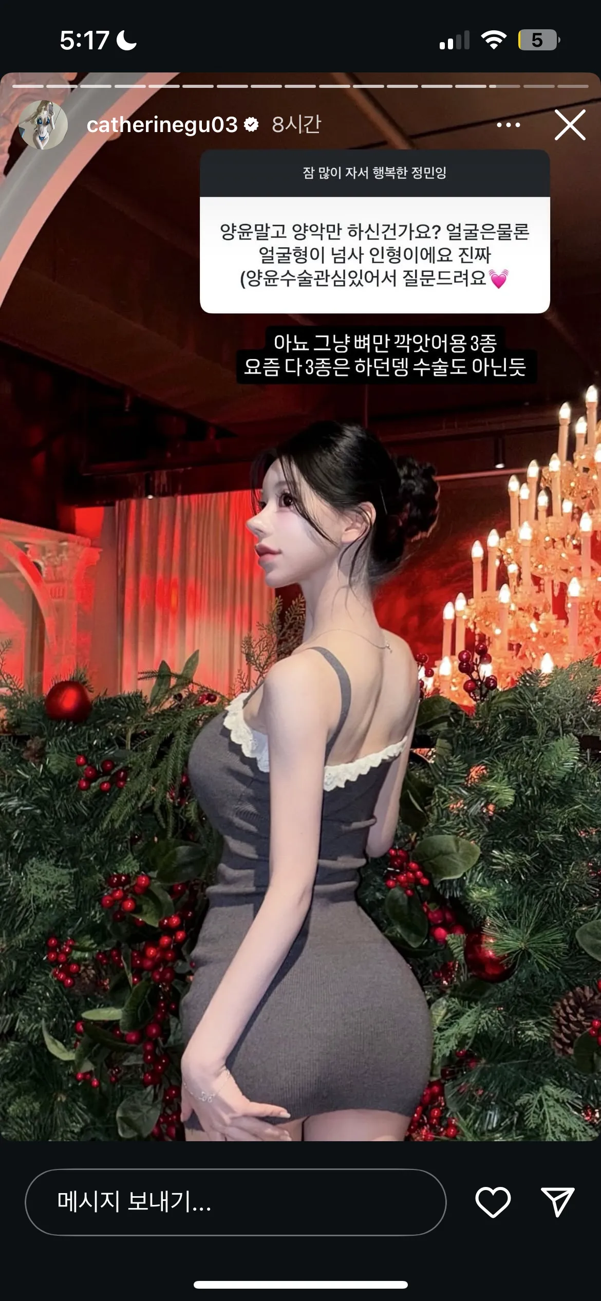 머라는거야 윤곽 삼종이 어케 수술도아니야