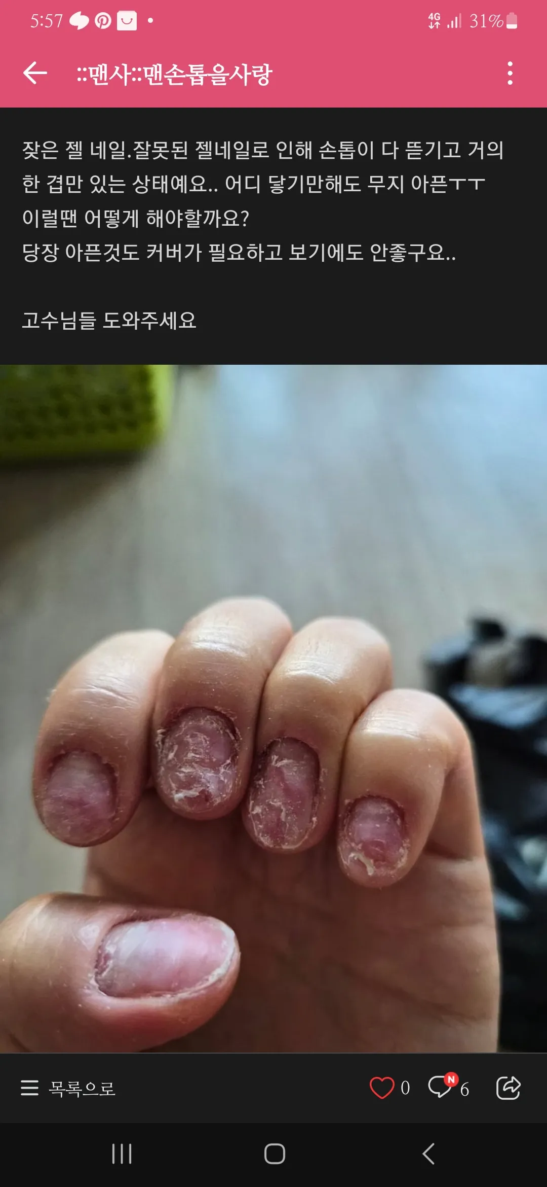 (사진 혐)이거 ㅇㅈ 맞져?2