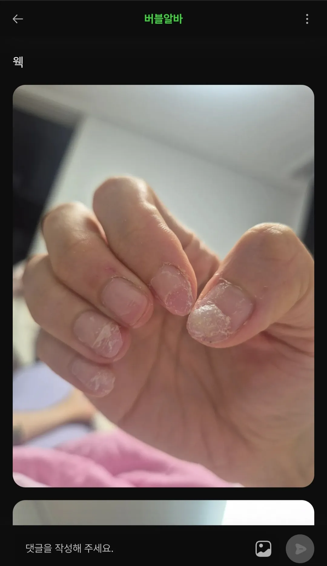 (사진 혐)이거 ㅇㅈ 맞져? 댓글