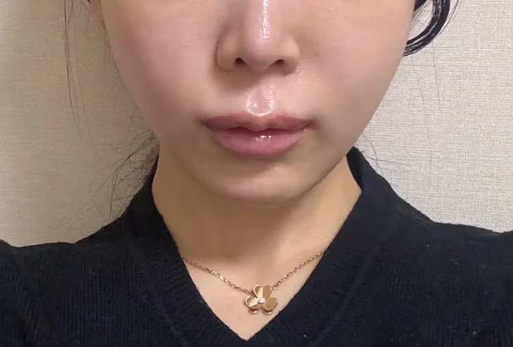 하 윤곽2주차인데 어때보여요2