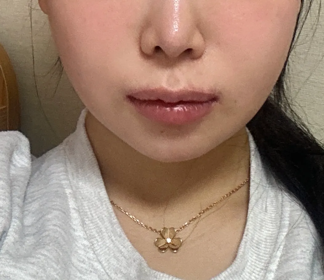 하 윤곽2주차인데 어때보여요3
