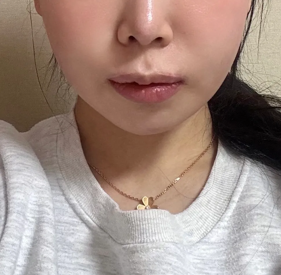 하 윤곽2주차인데 어때보여요4