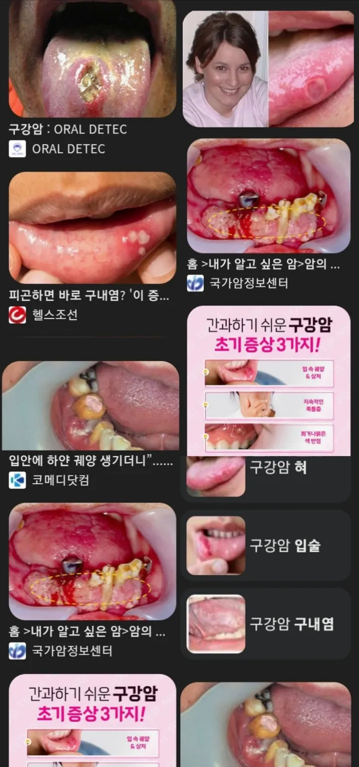 수위조언니들 산부인과 주기적으로 가요?? 댓글