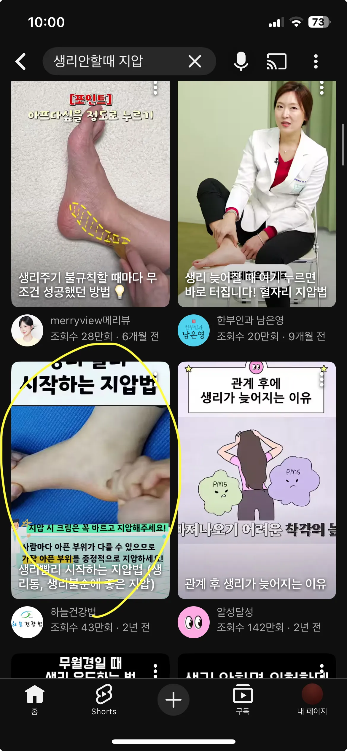 생리를 안해요.. 댓글