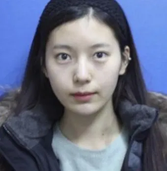 올해 10월 입문 24살 직장인일때 한 성형들 댓글