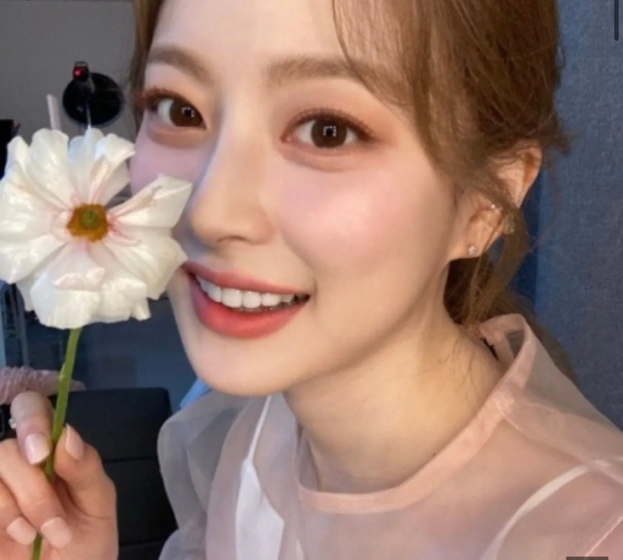 웃는거 개같이 안이쁜데 라미네이트하면