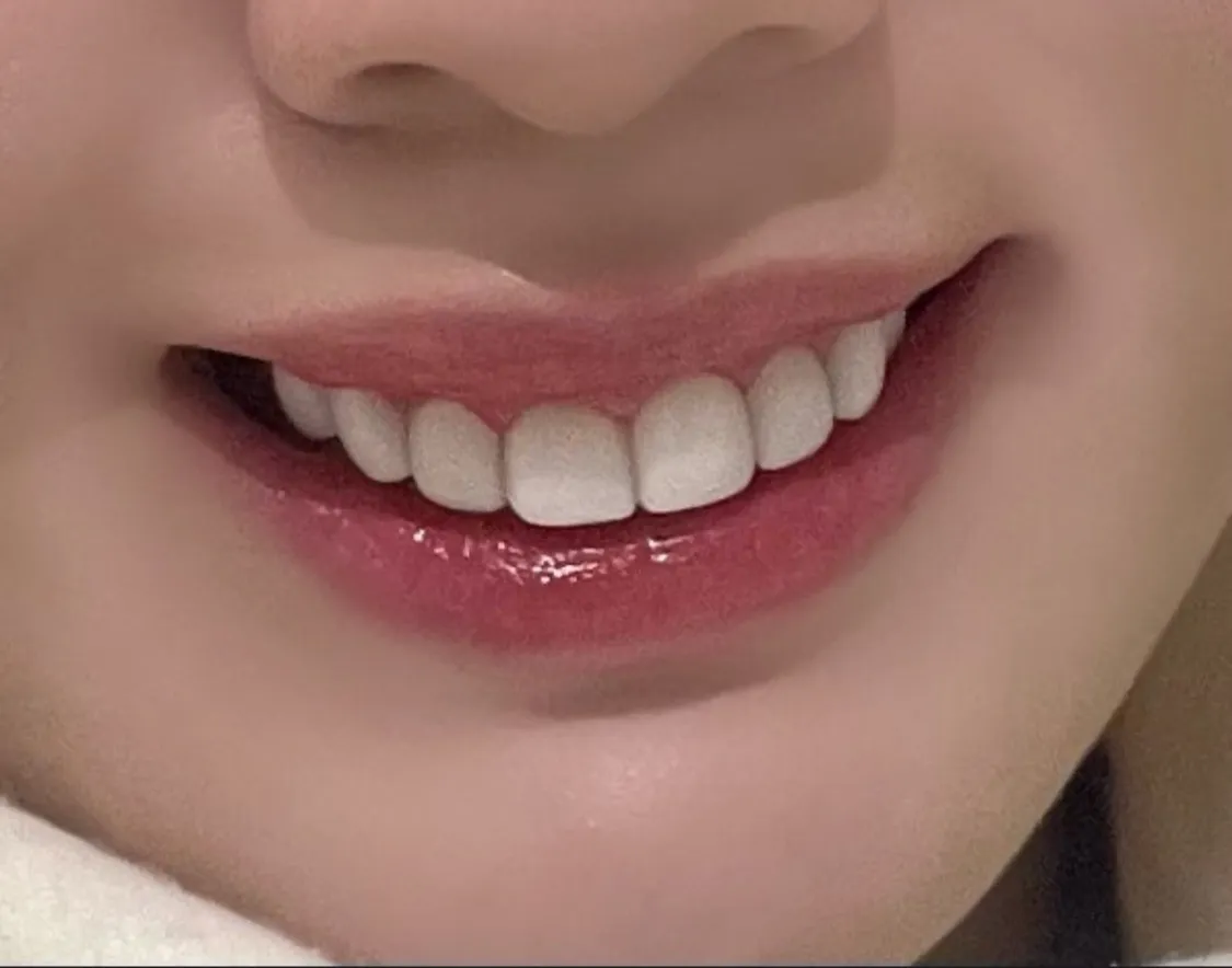 웅니들 이 중에 가장 모양 이쁜 치아 골라주세오