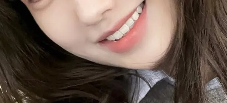 웅니들 이 중에 가장 모양 이쁜 치아 골라주세오3