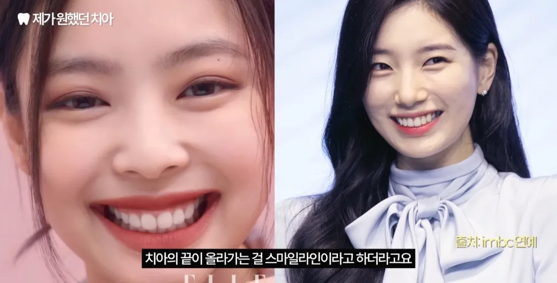 웅니들 이 중에 가장 모양 이쁜 치아 골라주세오5