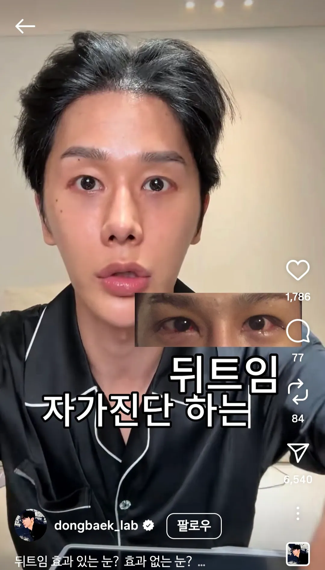 뒤트임흉 개쩌는 남자 인스스 댓글