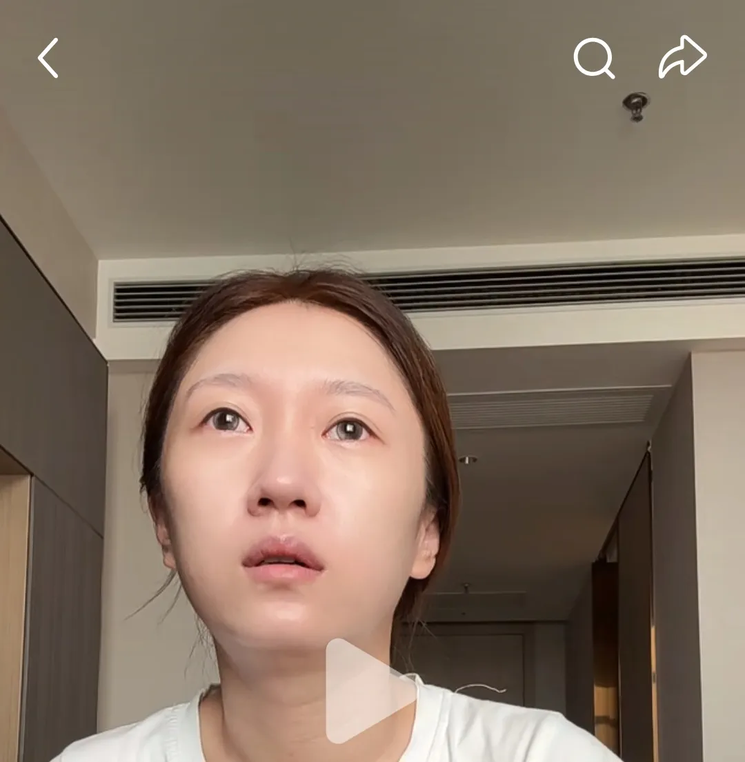 눈깔 생기존나 없는거 고쳐지나여
