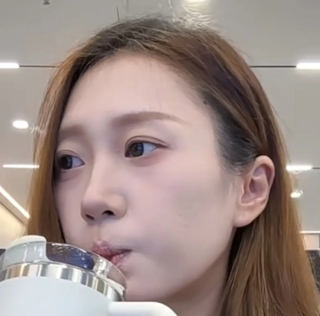 눈깔 생기존나 없는거 고쳐지나여3