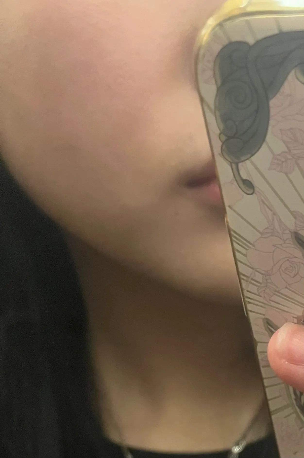팔자는 무슨 시술 해야돼여?