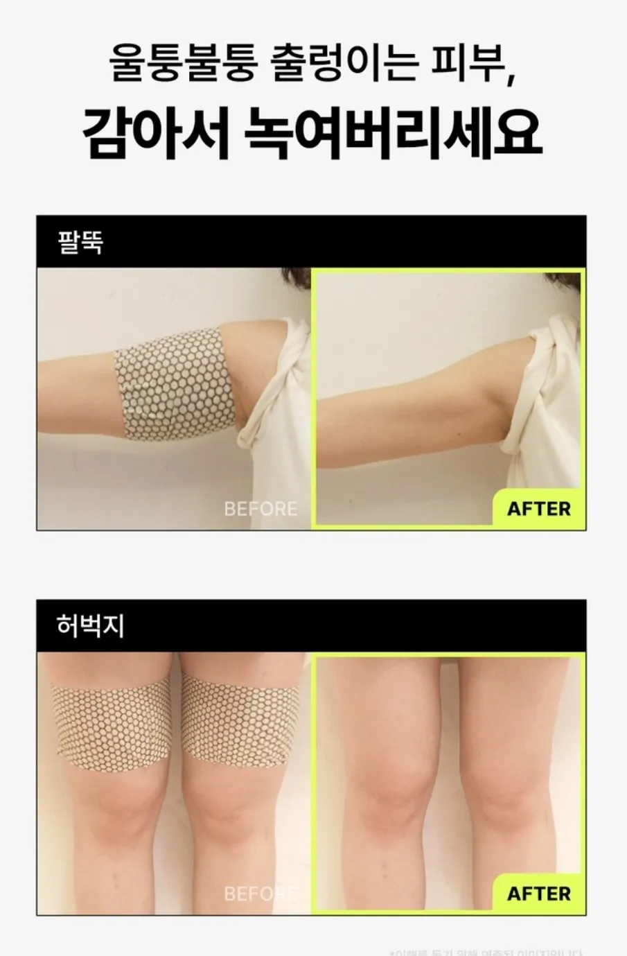 셀룰라이트 바디패치 밴드 사용해 보신분?4