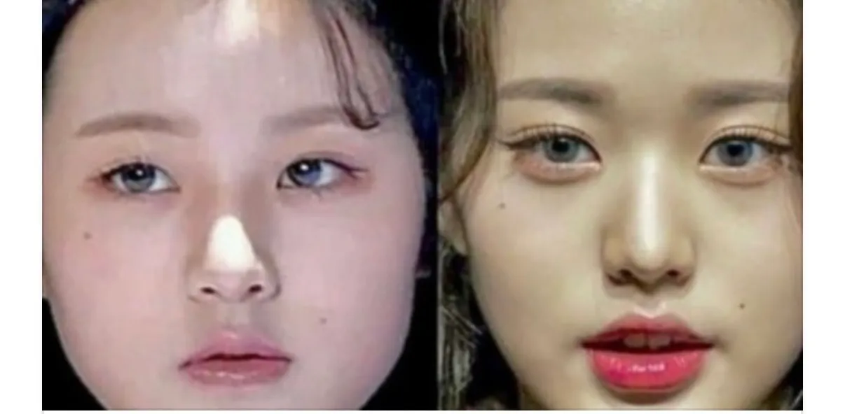이거 애교필러 맞은걸까요