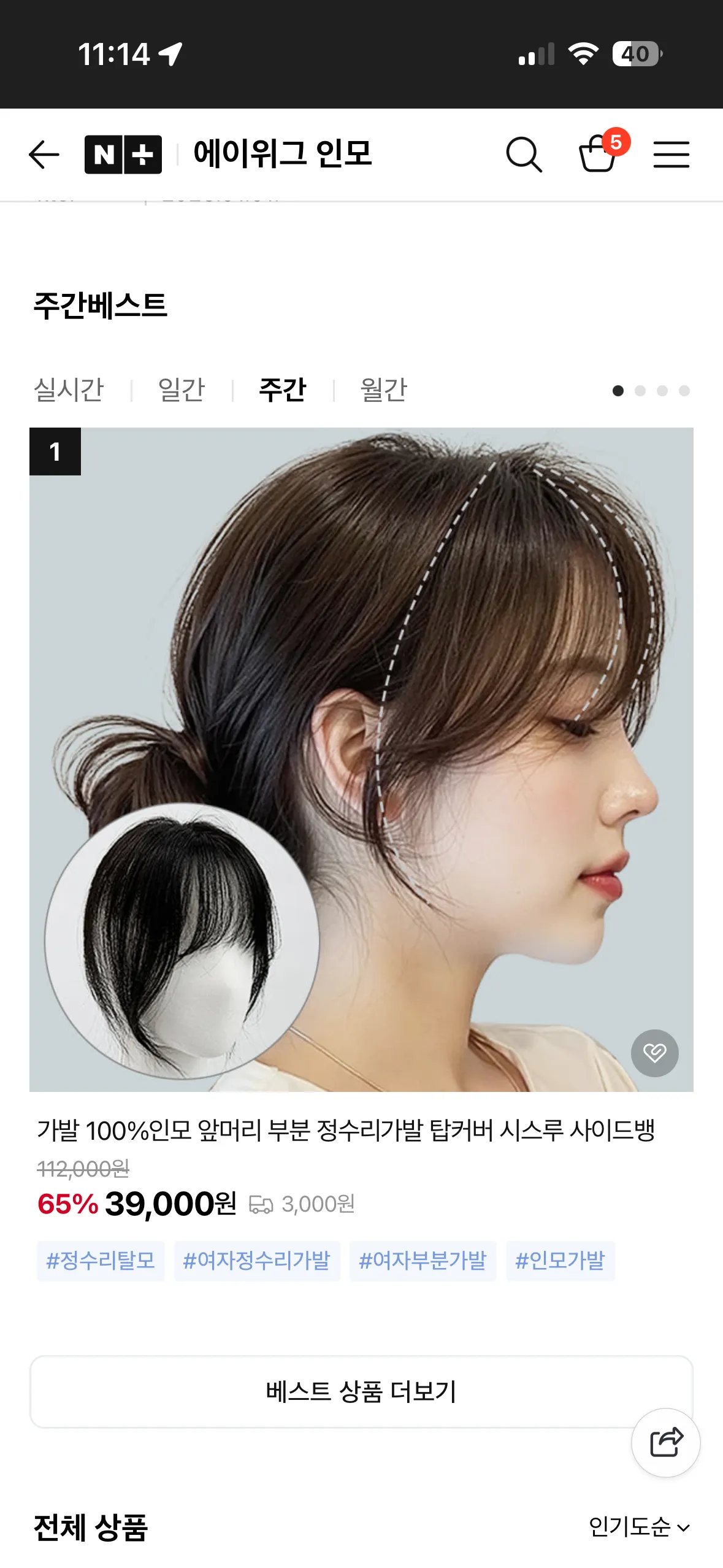 헤어라인 이식 2800모 예약해뒀는데