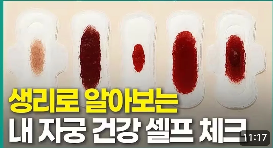 생리양 어떻게 되나요2